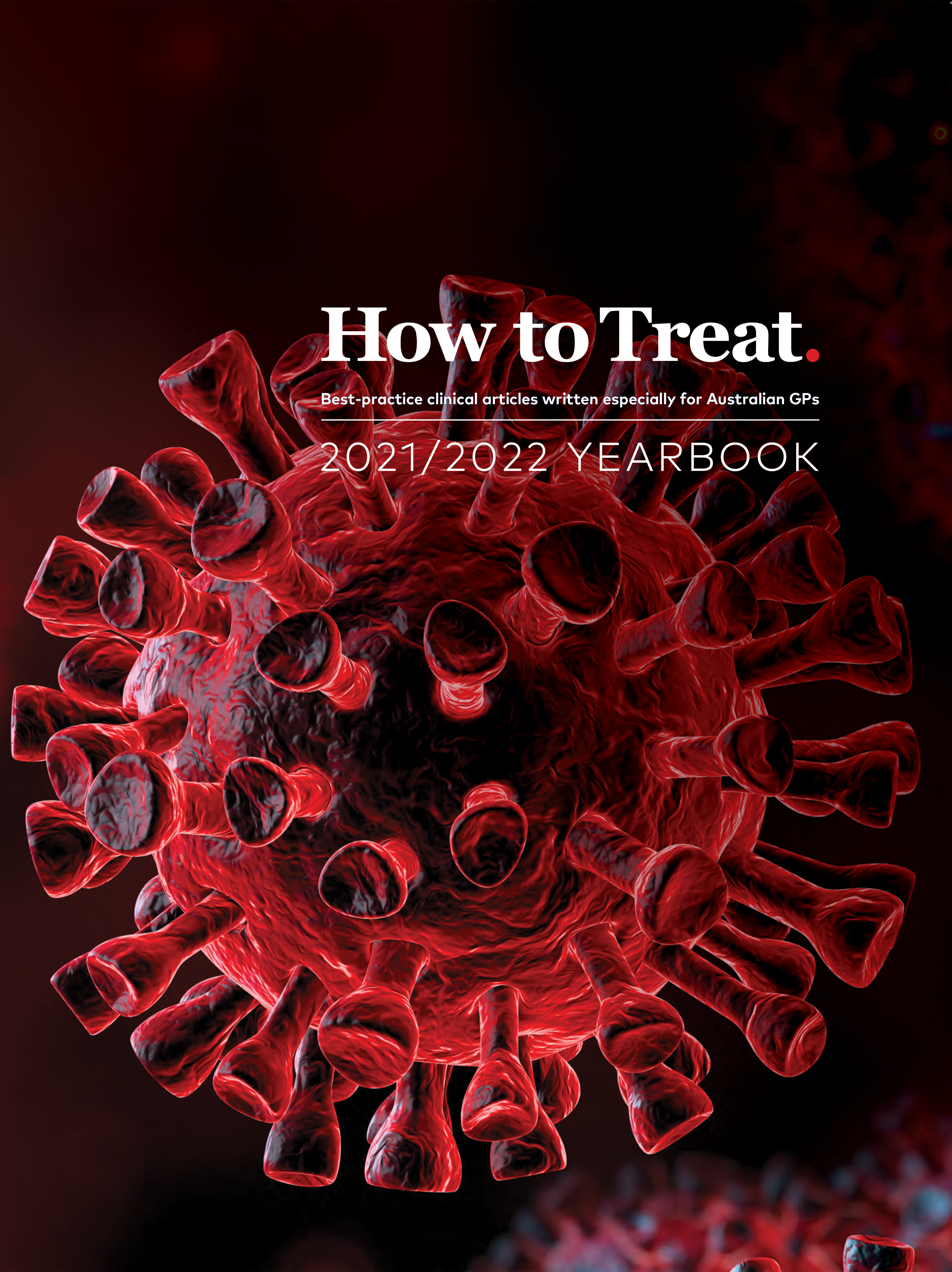 How to Treat Yearbook