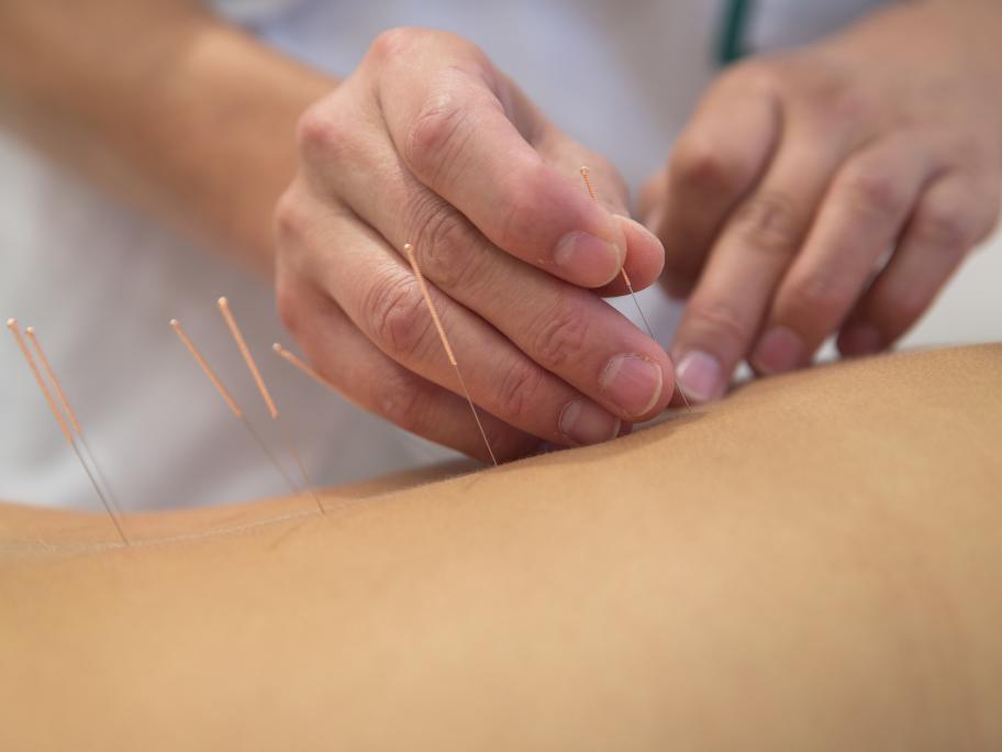 TCM chinese medicine