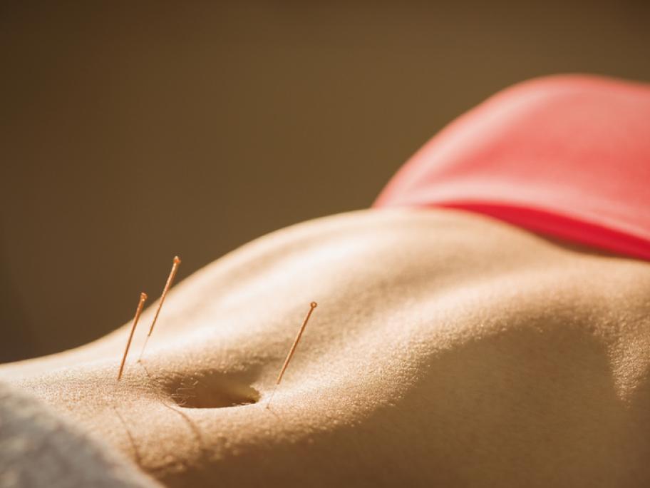 acpuncture woman's torso