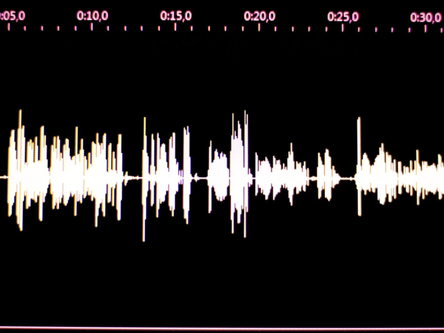 Audio recording GP consulstations