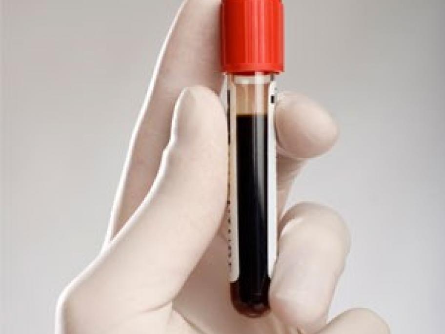 Blood test