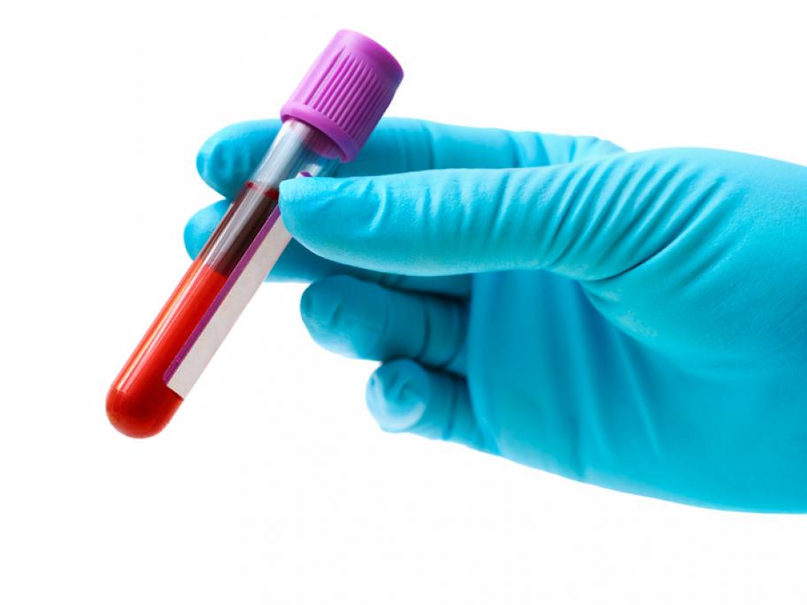 blood test