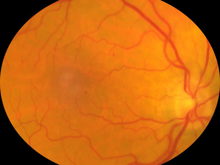 eye problems