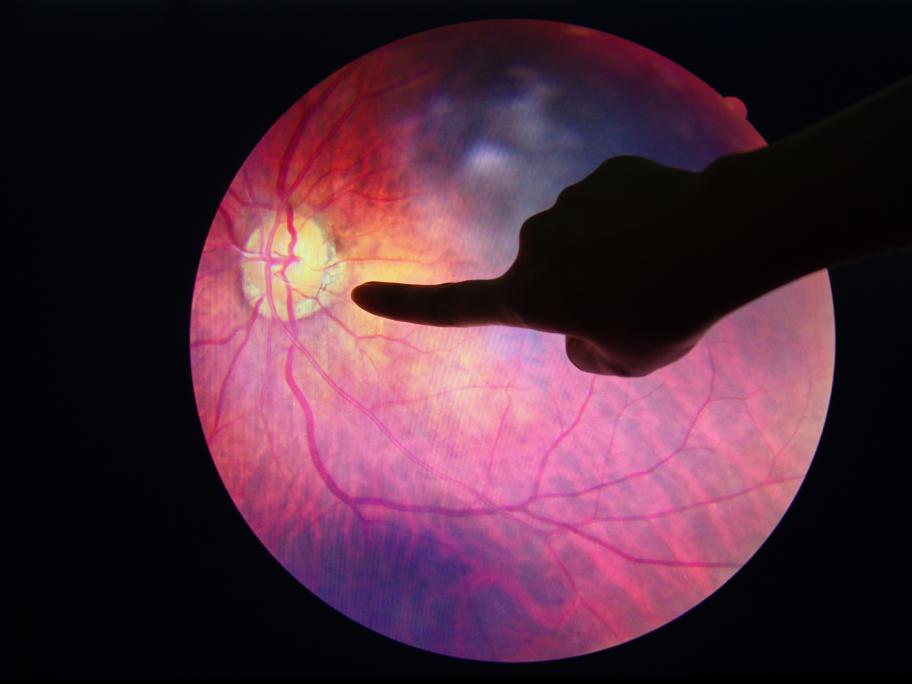Eye checks