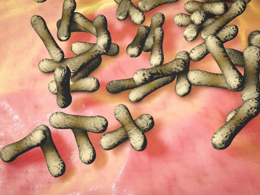 diphtheria bacteria