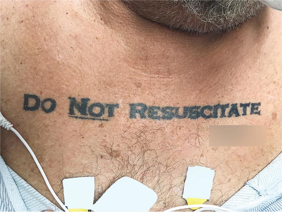 DNR tattoo