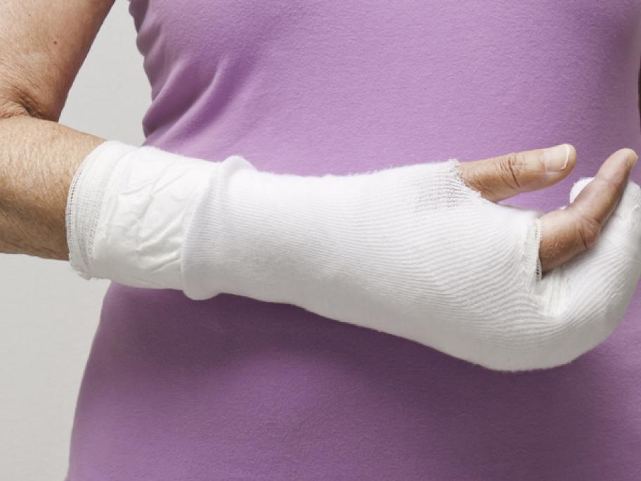 fracture