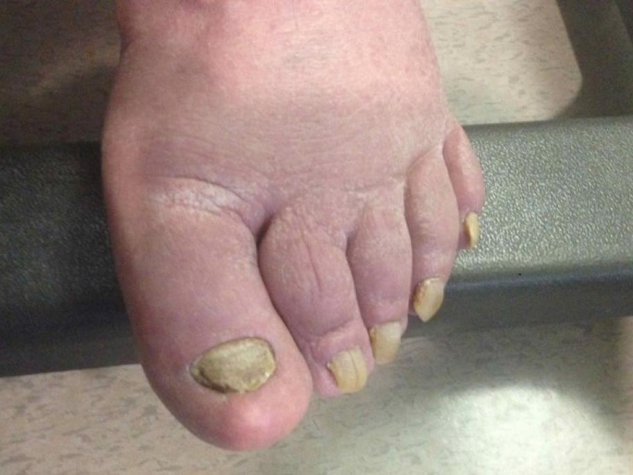 feet