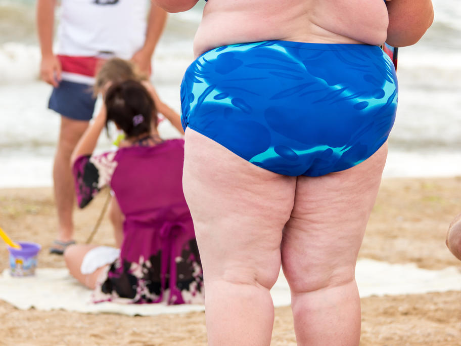 obese woman cancer risk
