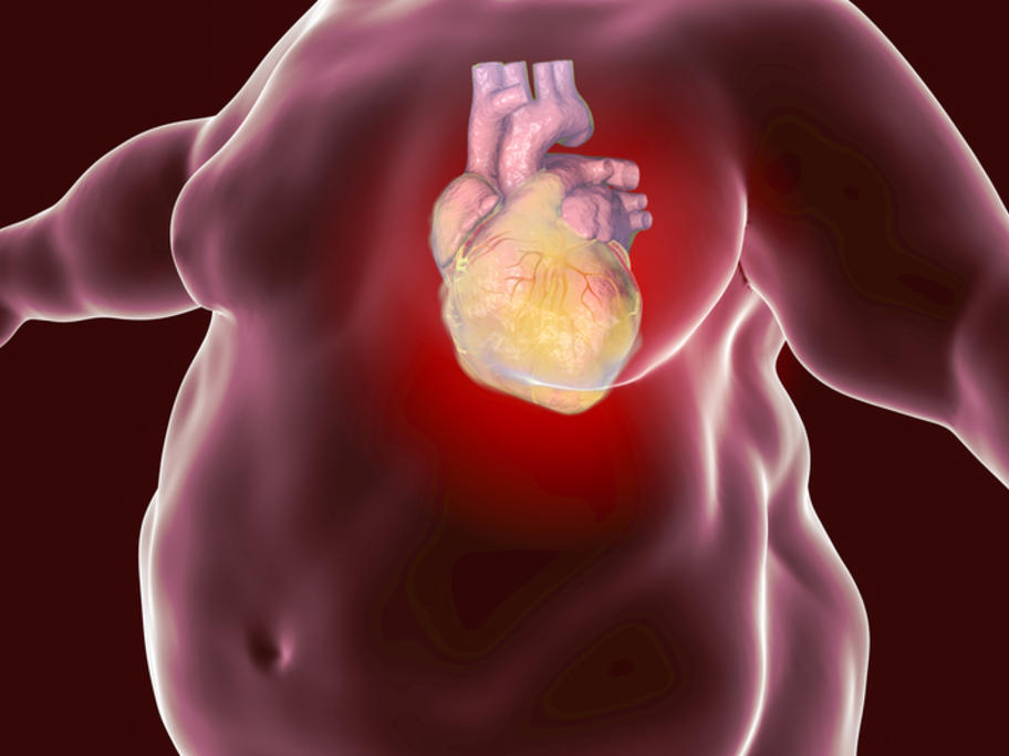 Obesity and heart disease