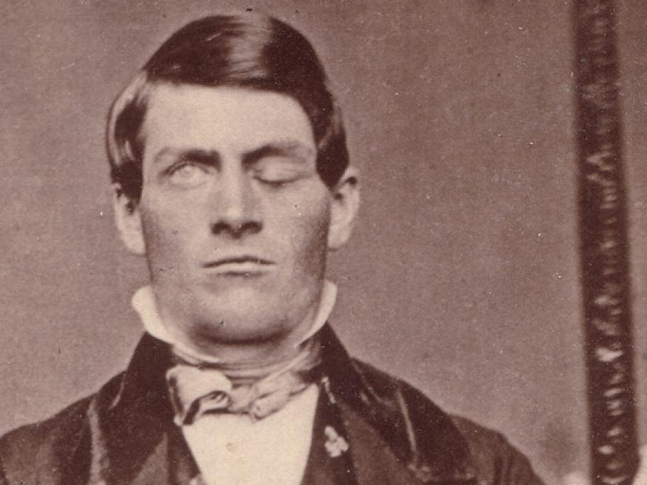 Phineas Gage