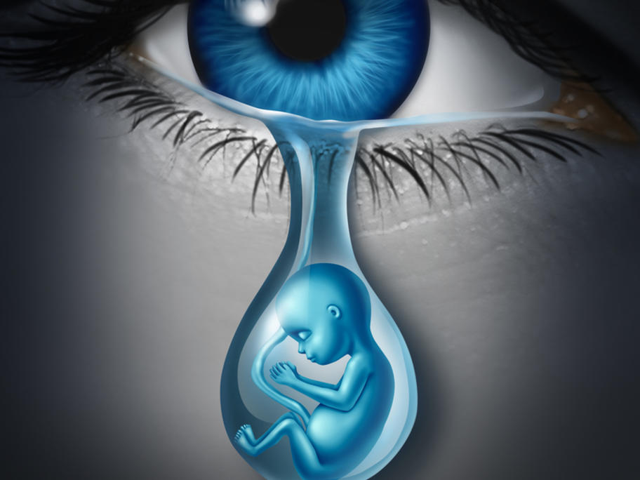 postnatal depression concept