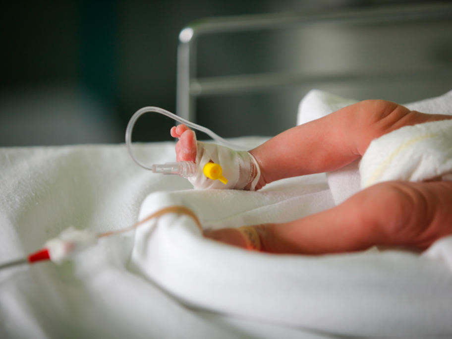 preterm baby
