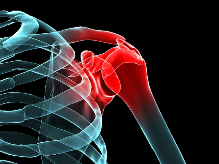 painful shoulder
