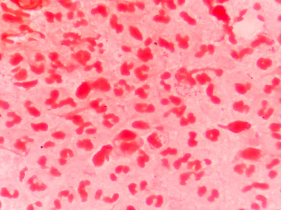 STI petri dish