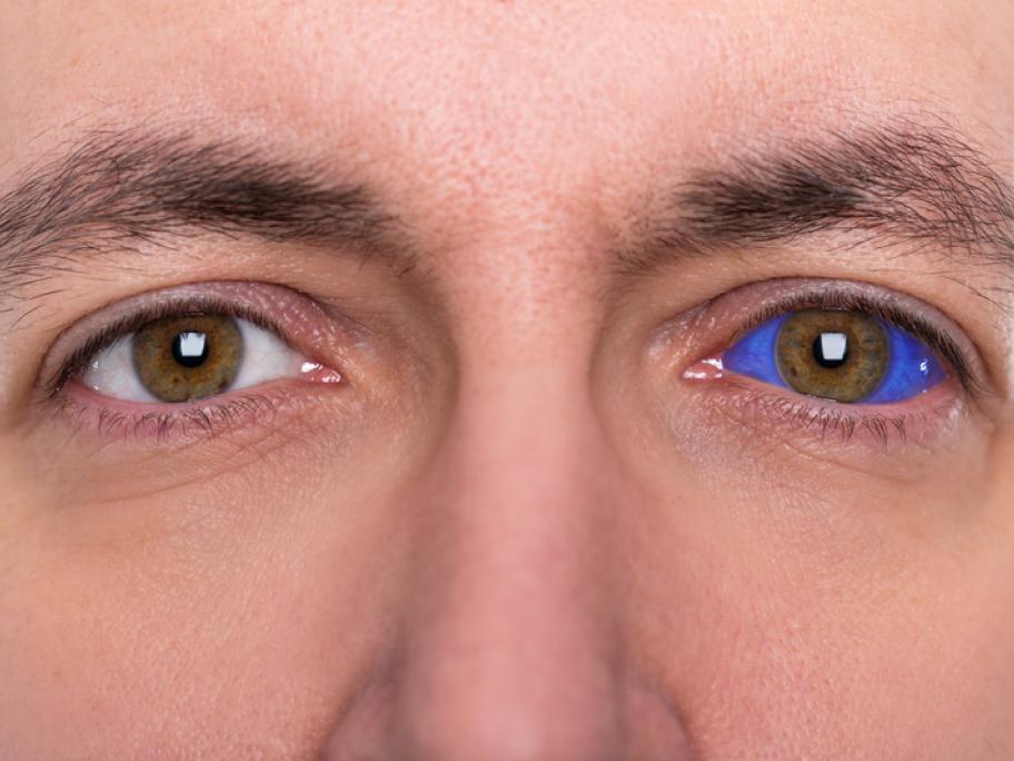 tattooed eyeball