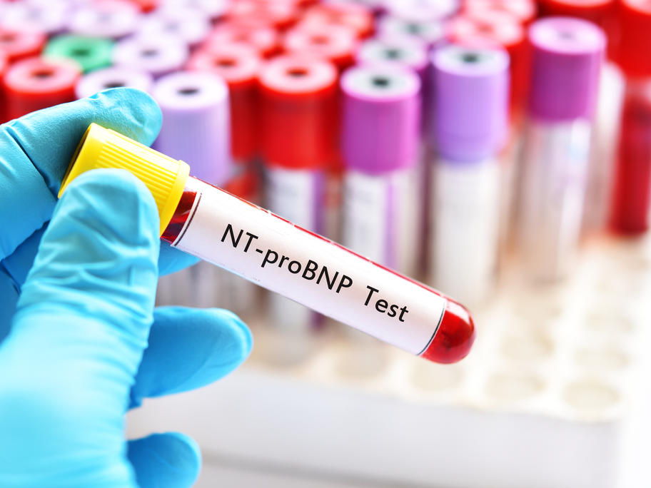 BNP test