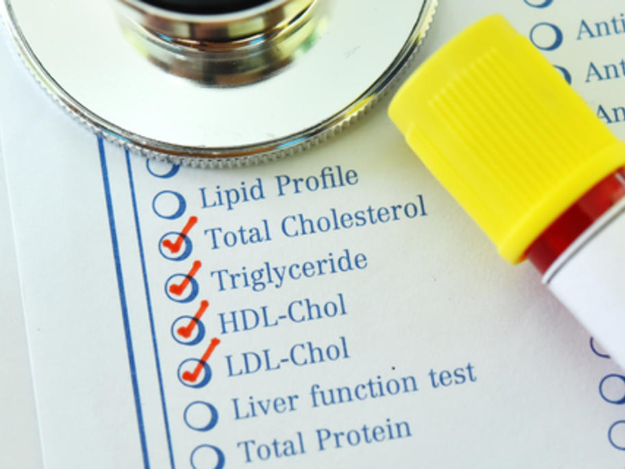 Test ordering LDL cholesterol