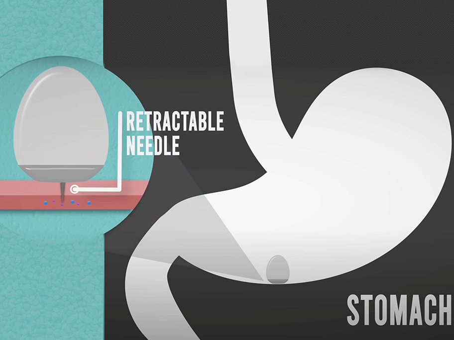 MIT injection pills
