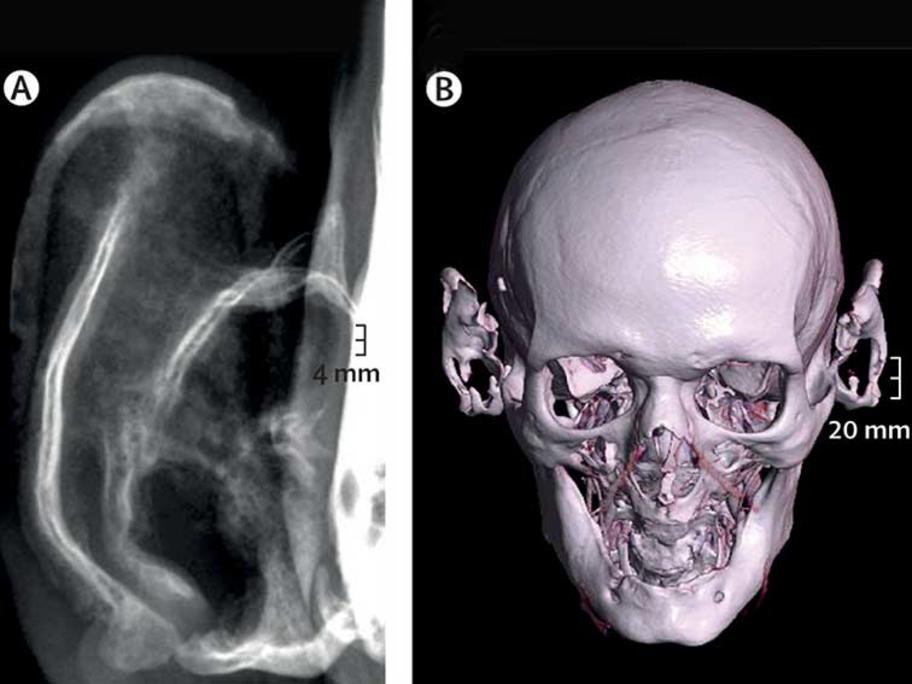 X-ray and CT
