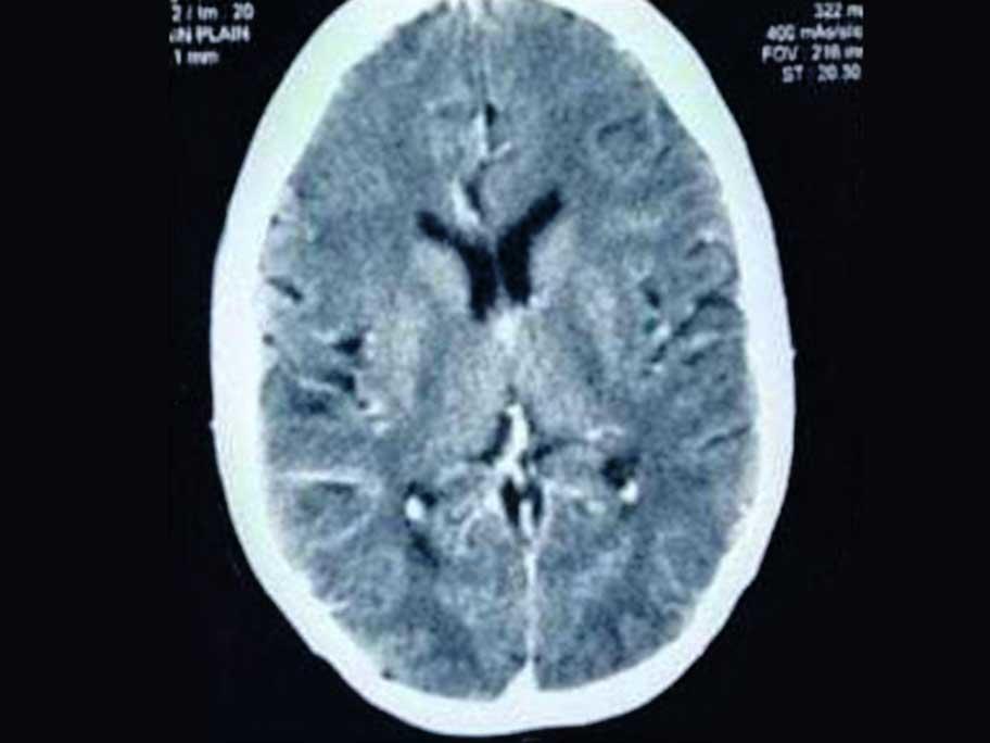 CT scan