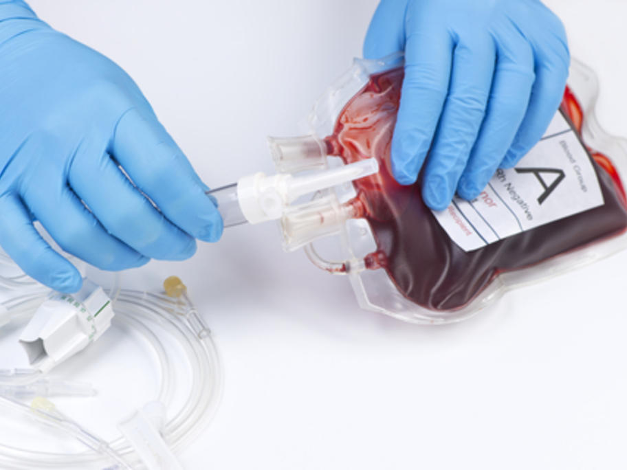 blood transfusion - gloved hands attaching drip to bag