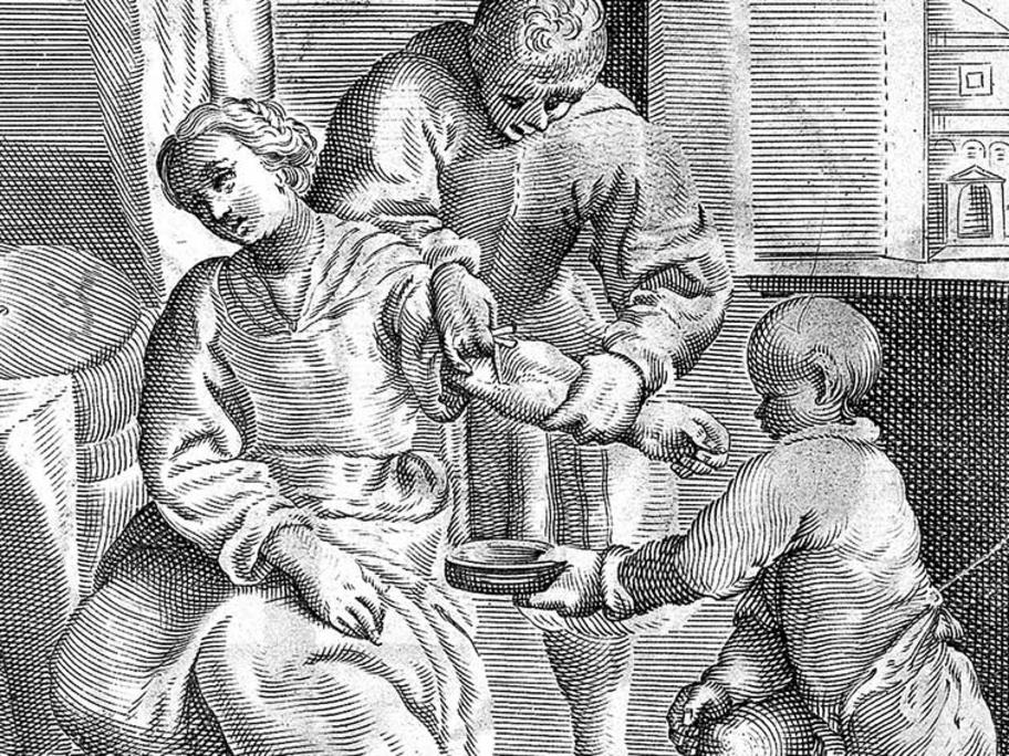 bloodletting