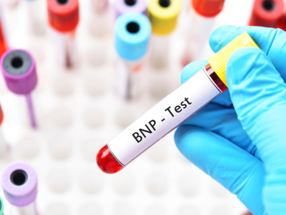 Blood test for B-type natriuretic peptide