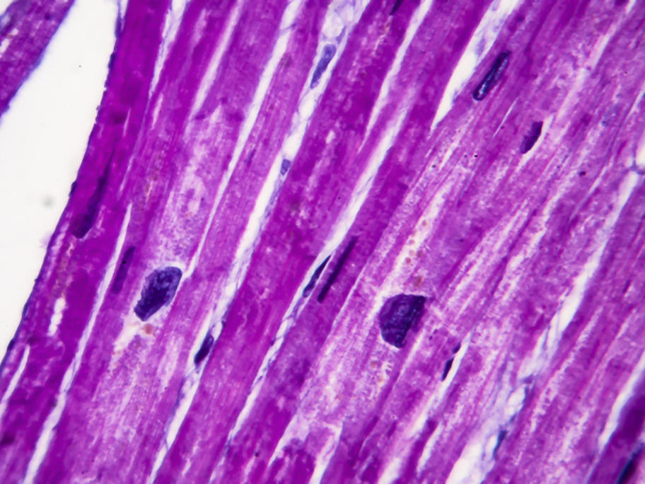 Histologogy pic - cardiac myocytes