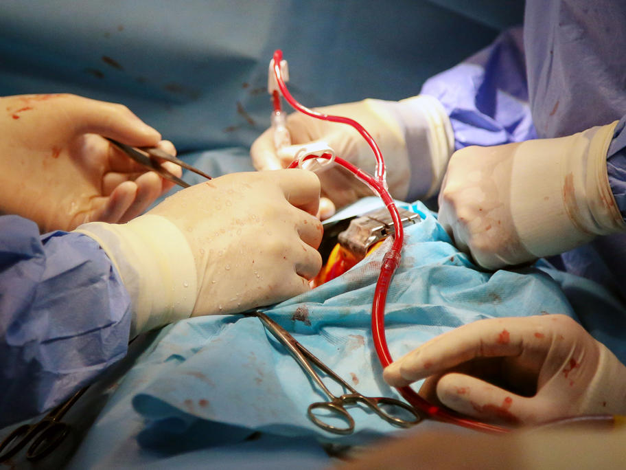 Cardiac surgery
