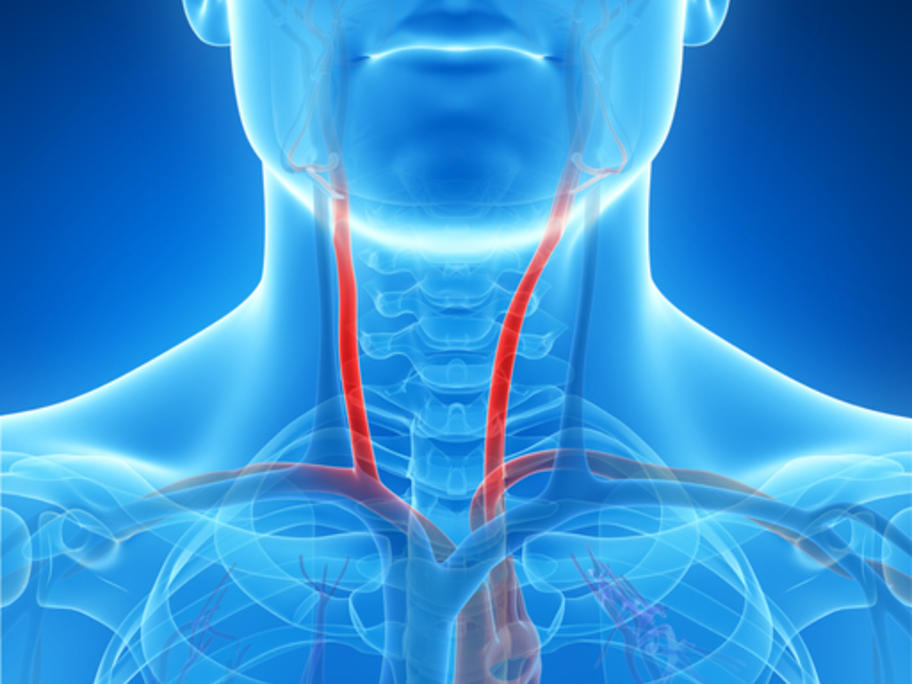 carotid artery illustration