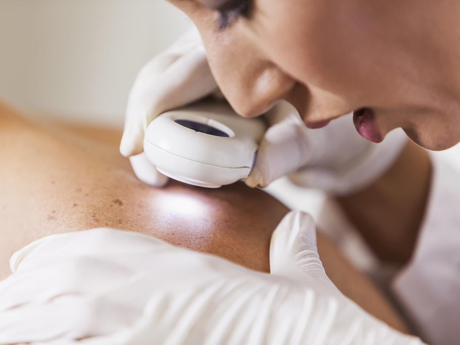 dermatologist examinIng patient