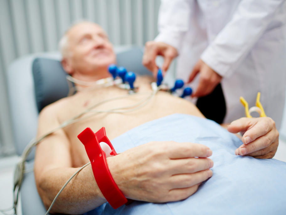 ECG