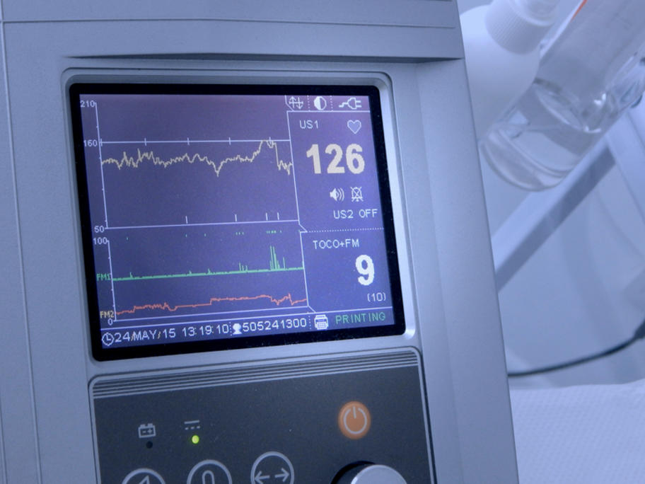 fetal heart rate