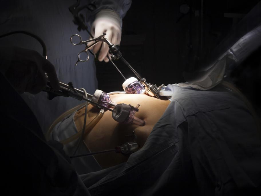 Gastric bypass surgery