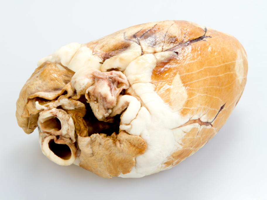preserved heart