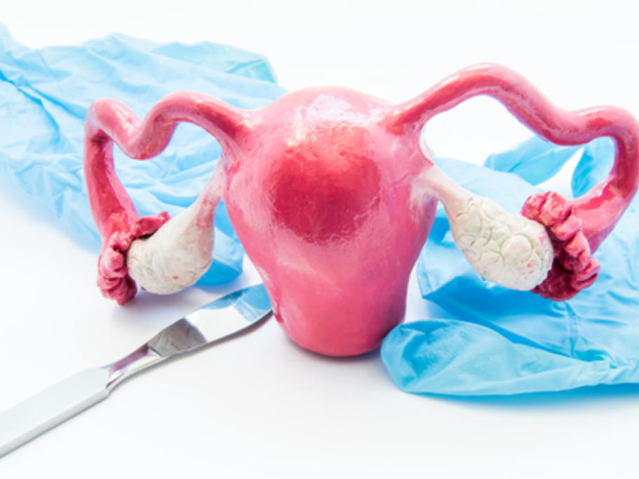 hysterectomy concept