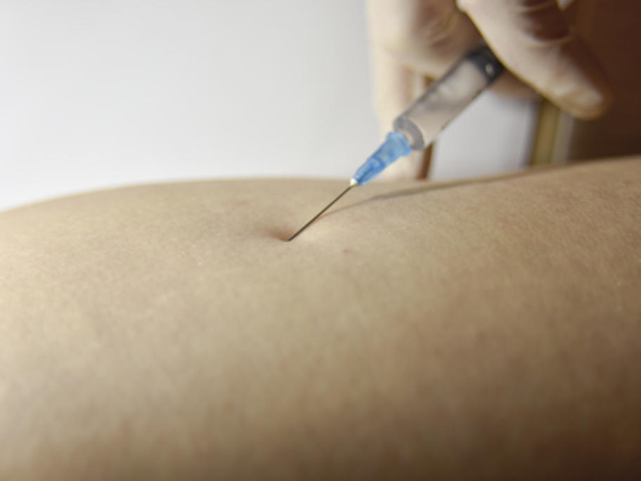intramuscular injection