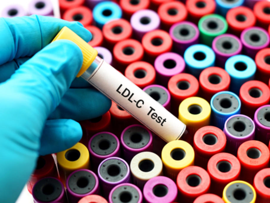 LDL-C test