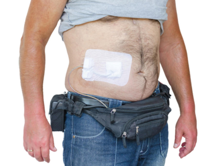 young man with left ventricular assist device