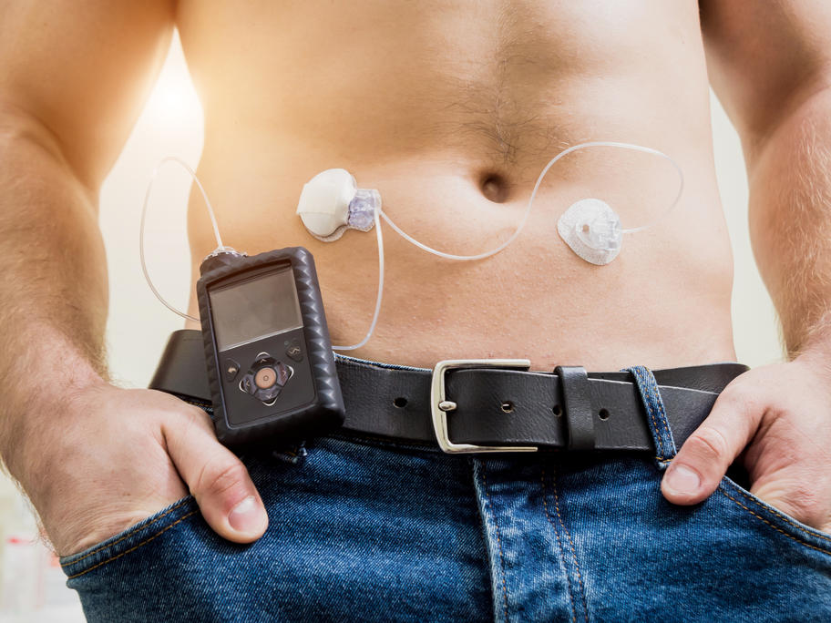 young man with insulin pump