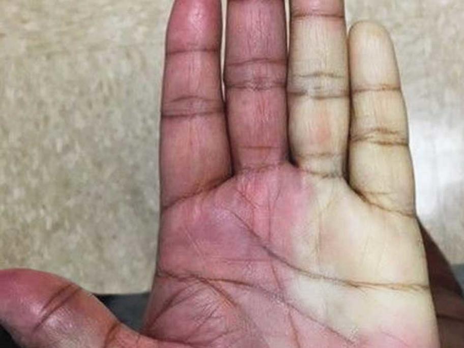 Hand