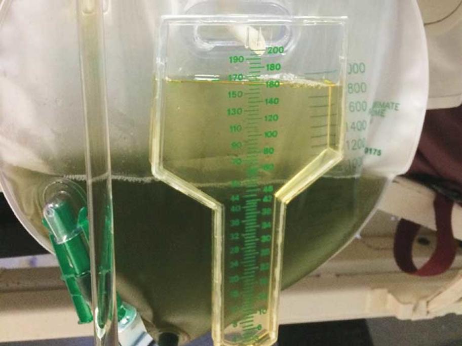 Must See Green Urine Nejm ?XFPLxgAK2hC2PirdF9xgSQ10VcGC.Sd.&itok=OLfxmOez
