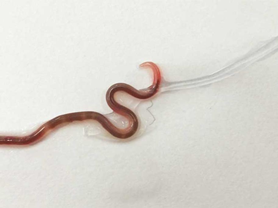 Worm