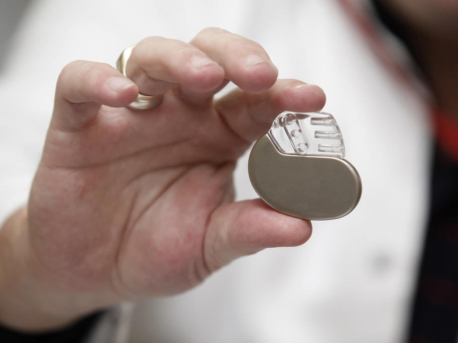 doctor holding pacemaker