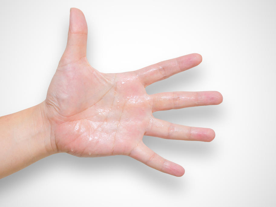 sweaty woman's hand