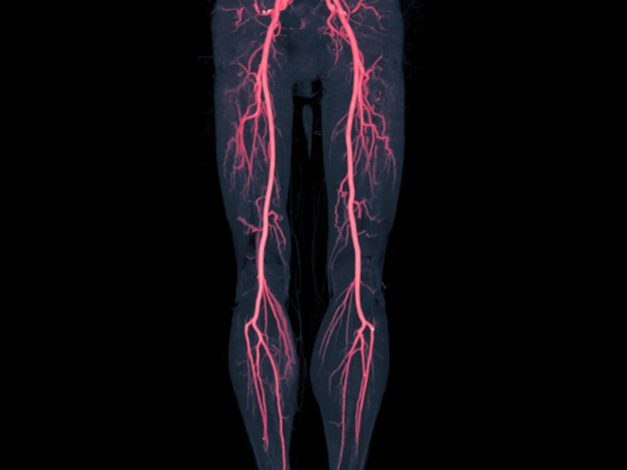 arteries of the legs