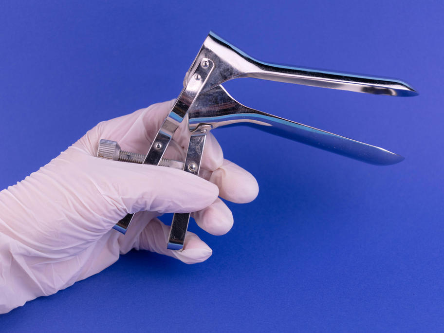 Speculum