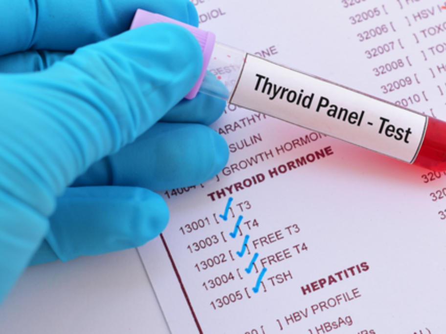 blood vial for thyroid function test