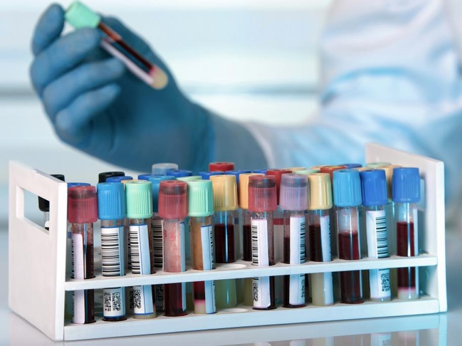 Blood tests